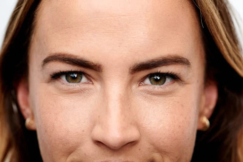 Wie kann man Augenringe loswerden?