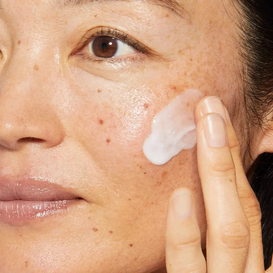 Eine Person trägt Phyto Nature e² Exosom Treatment + Phyto Nature Oxygen Cream mit den Fingern auf die Wange auf, so dass die Haut ein taufrisches Finish erhält und Sommersprossen und Muttermale sichtbar werden.