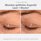 Vorher- und Nachher-Nahaufnahmen eines Augenlids, die die Hautstruktur einer Phyto Nature Lifting Eye Cream nach einer Woche Behandlung zeigen.