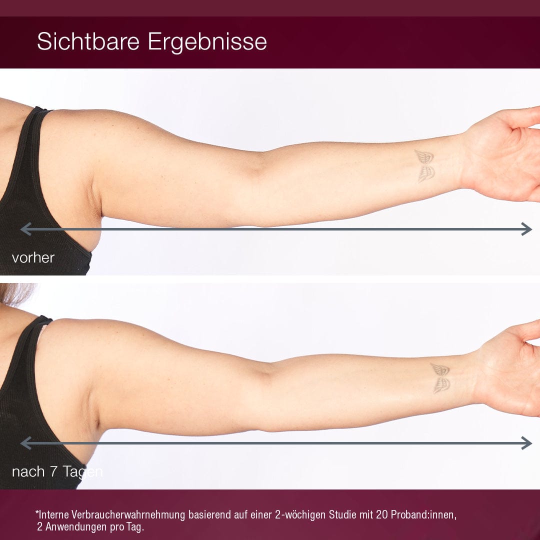 Seite-an-Seite-Vergleich des Arms einer Person vor und nach 7 Tagen Anwendung des Dynamic Skin Sculptor, der eine sichtbar straffere und glattere Haut zeigt. Die Textetiketten lauten "vorher" und "nach 7 Tagen".