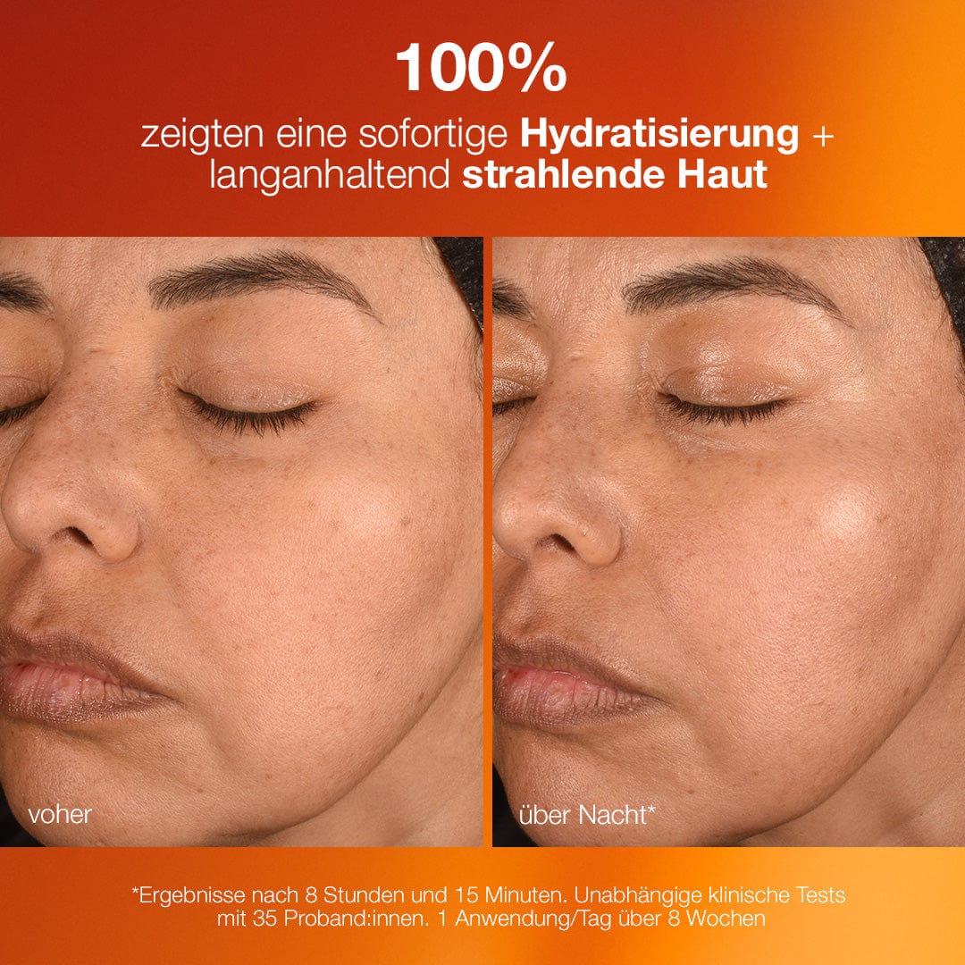 Nebeneinanderstellung des Gesichts einer Person vor und nach der Verwendung eines Hautpflegeprodukts