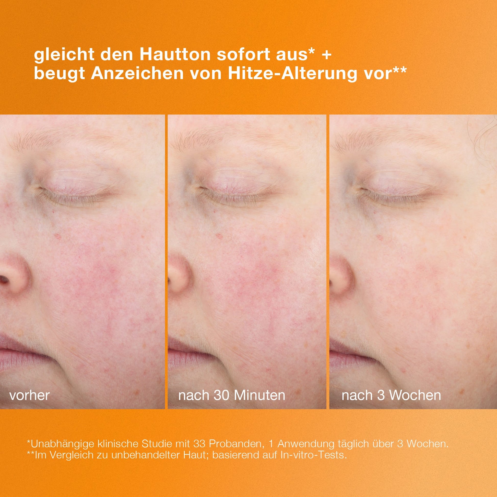 Nahaufnahmevergleich der Wange einer Person, der die Verbesserung des Hautbildes im Zeitverlauf zeigt – vor der Anwendung, nach 30 Minuten und nach 3 Wochen – mit einem deutschen Text über den „Biolumin-C Heat Aging Protector LSF 50“ für einen gleichmäßigen Teint und wirksamen Anti-Aging-Schutz.