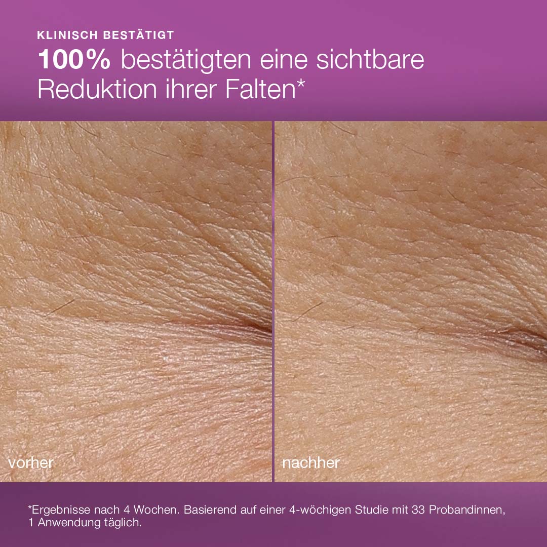 Nahaufnahme von Haut vor und nach der Anwendung: links gestresste Haut mit Falten ("vorher"), rechts ebenmäßiger Teint ("nachher"). Text bestätigt die Faltenreduktion durch die MultiVitamin Power Recovery Cream.