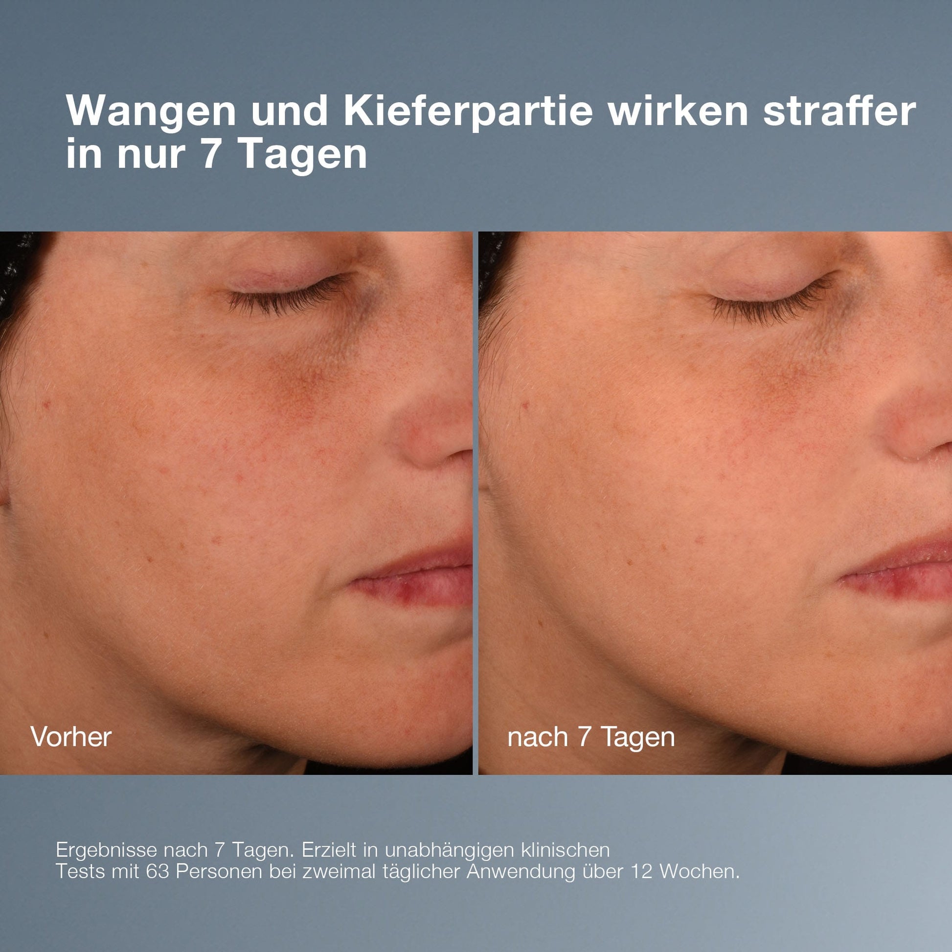 Der Nahvergleich einer Wangen- und Kieferpartie vor und nach 7 Tagen mit Pro-Collagen Banking Serum zeigt auf dem zweiten Bild eine sichtbar glattere, straffere Haut. Der deutsche Text enthält Details zu den Tests und Ergebnissen.