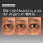 Drei Nahaufnahmen zeigen die Haut unter den Augen vor der Behandlung, nach 4 Wochen und nach 8 Wochen und veranschaulichen die gesteigerte Hautdichte im Augenbereich durch die Anwendung unseres Smart Eye Density Serums.