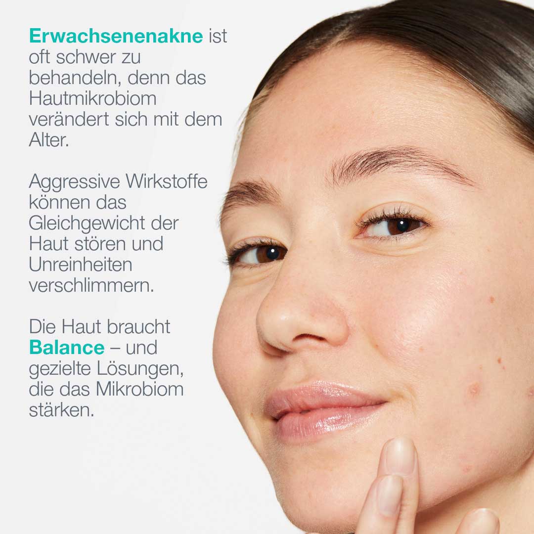 Eine Frau mit reiner Haut berührt ihre Wange neben einem deutschen Text über Akne bei Erwachsenen, das Hautmikrobiom und eine ausgewogene Pflege unter Verwendung von Breakout Biotic Moisturizer mit Salicylsäure gegen Hautunreinheiten.